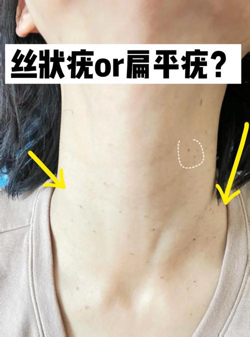 扁平化是什么意思啊「现在为什么扁平化这么严重」 百度SEO 扁平化是什么意思啊「现在为什么扁平化这么严重」 扁平化是什么意思啊「现在为什么扁平化这么严重」 百度SEO